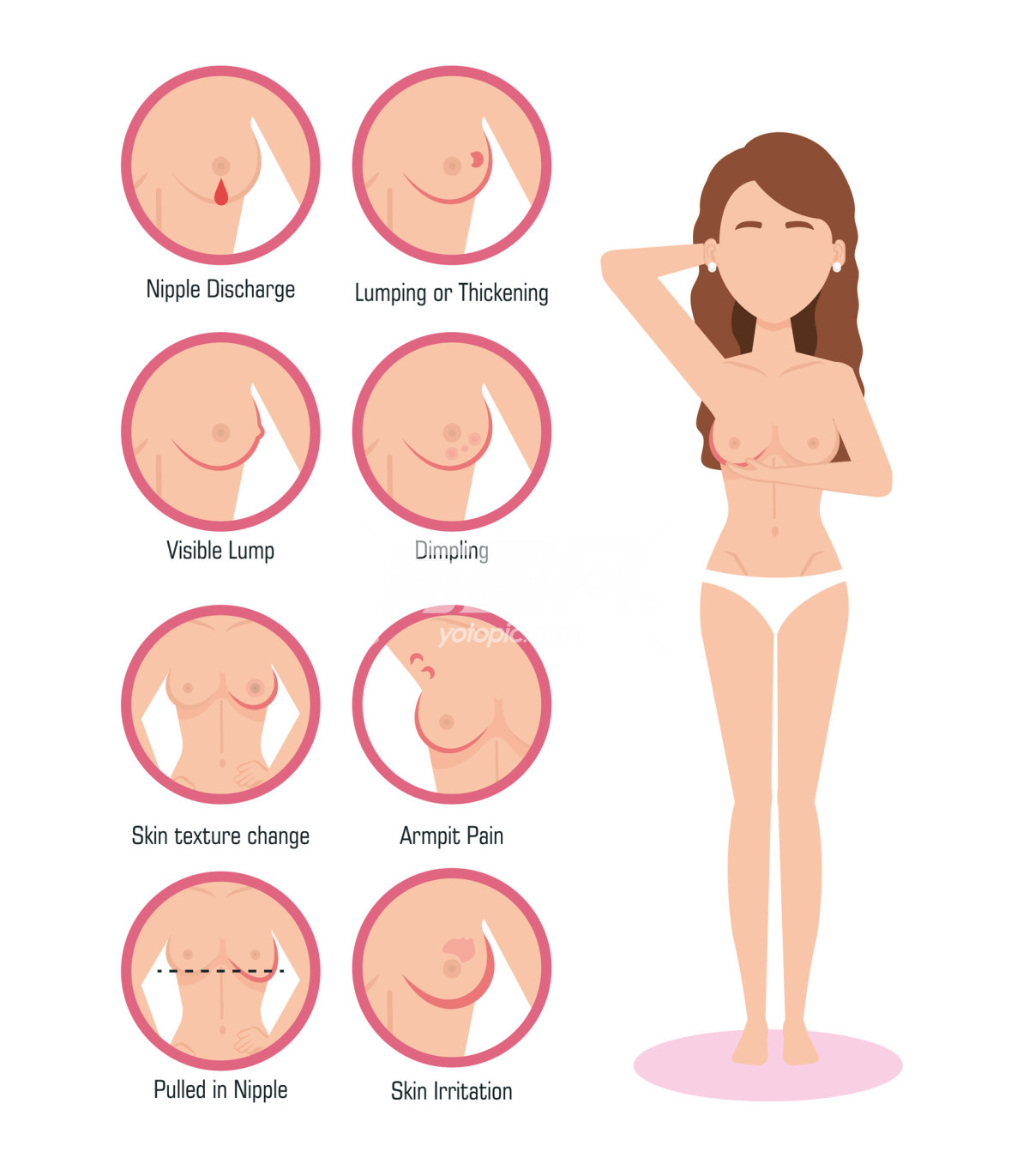 女性乳腺疾病插画