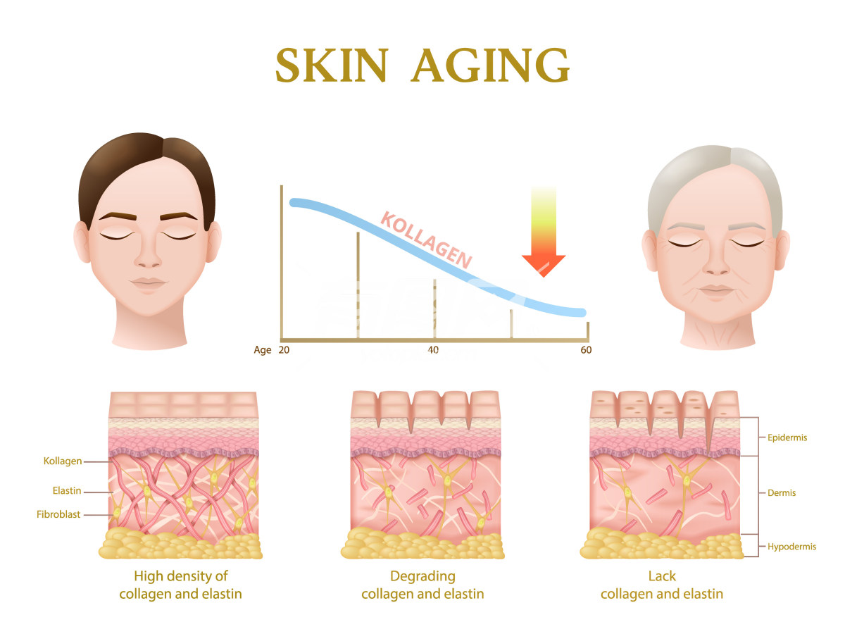 皮肤老化过程示意图