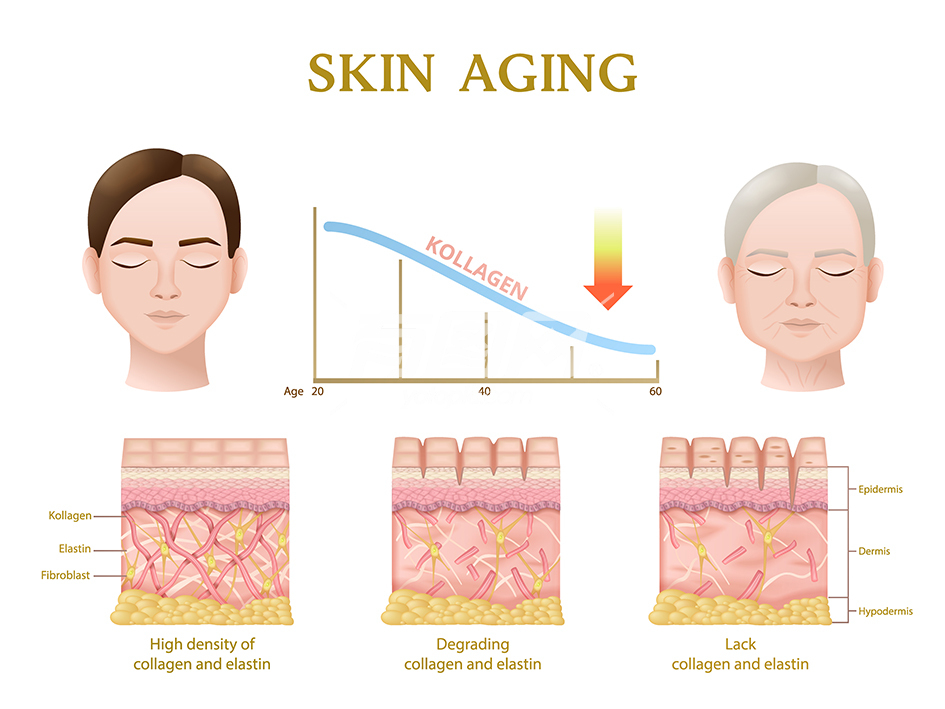 皮肤老化过程解剖